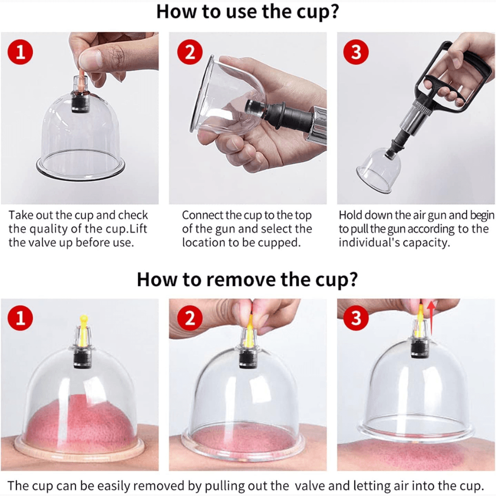 Kylin Professional Cupping Therapy 24pc Set